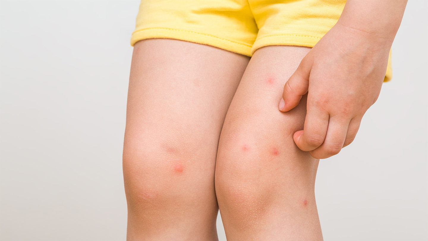Scratching an itch is so good, and so bad