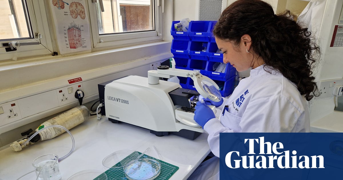 Scientists use living human brain tissue to accelerate the hunt for dementia | Alzheimer