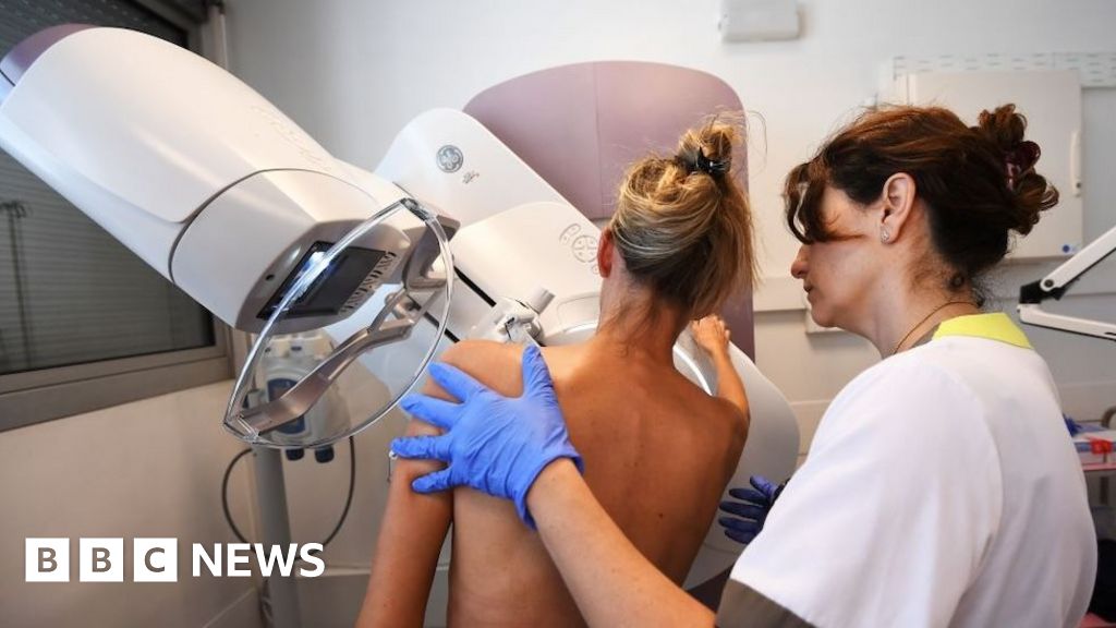 Male workers should be able to carry out mammograms, say experts