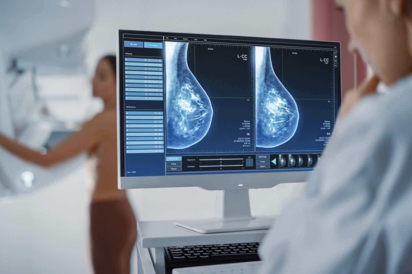 An additional examination of cancer could help raise early cases in thick breasts