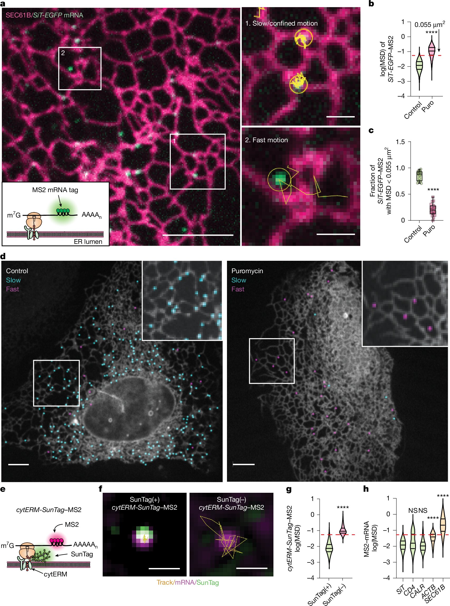 How cells orchestrate protein production through ER-lysosome interactions